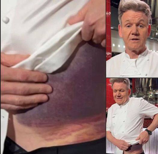 “I’m Lucky To Be Here”: Gordon Ramsay Shares Life Lesson After Harrowing Accident