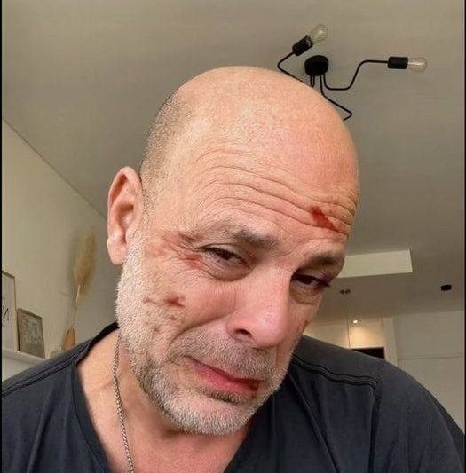 Bruce Willis’ wife Emma Heming shares heartbreaking video of him after his dementia diagnosis