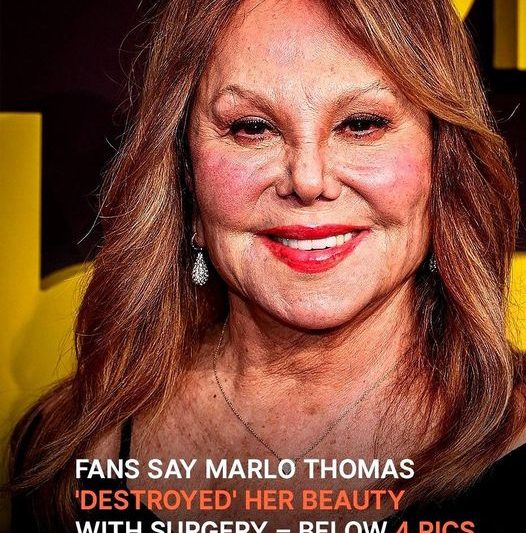 Fans Say Marlo Thomas ‘Destroyed’ Her Beauty with Surgery: How She Would Look Today Naturally via AI